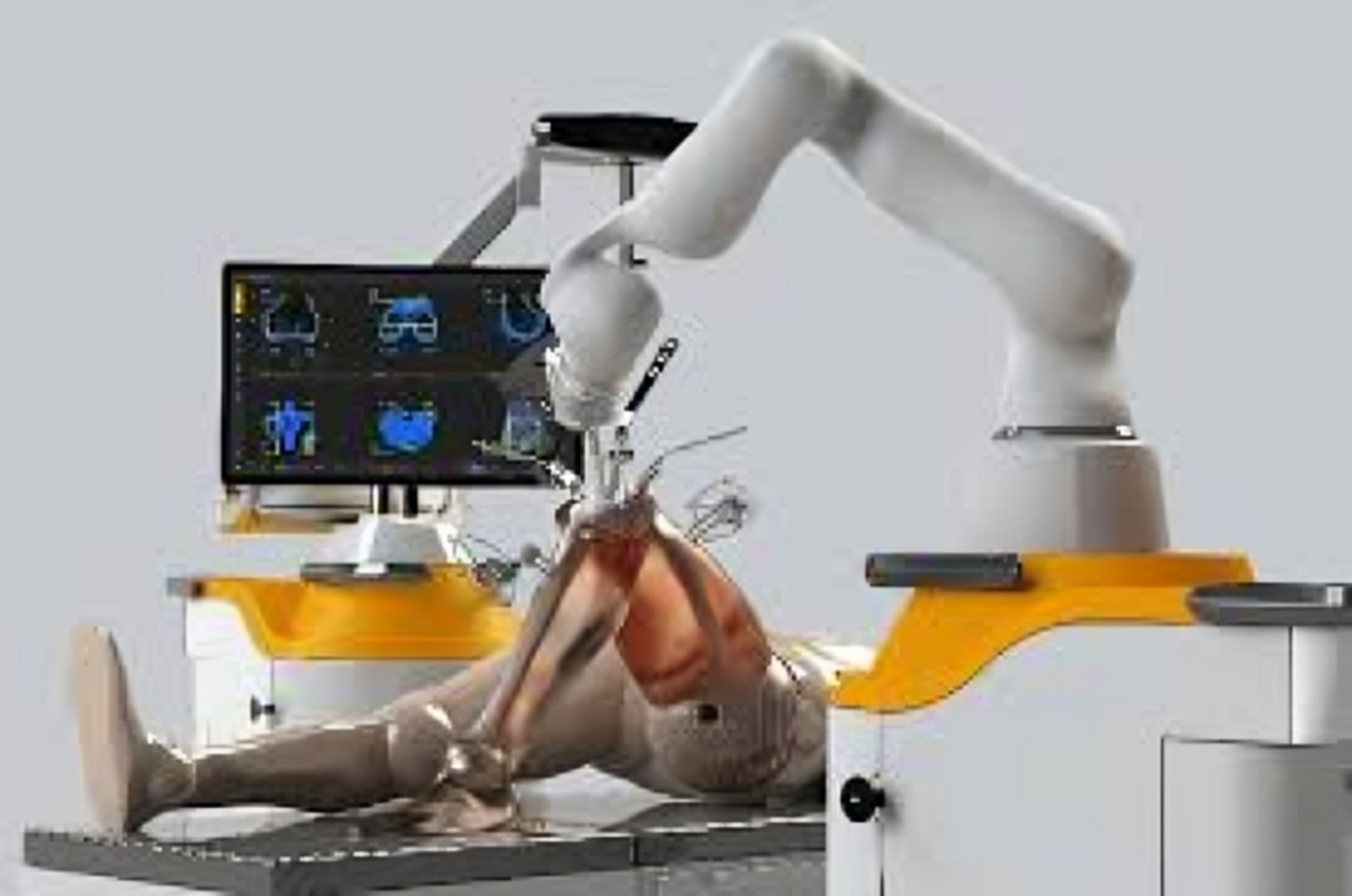 Robotic Joint Replacment