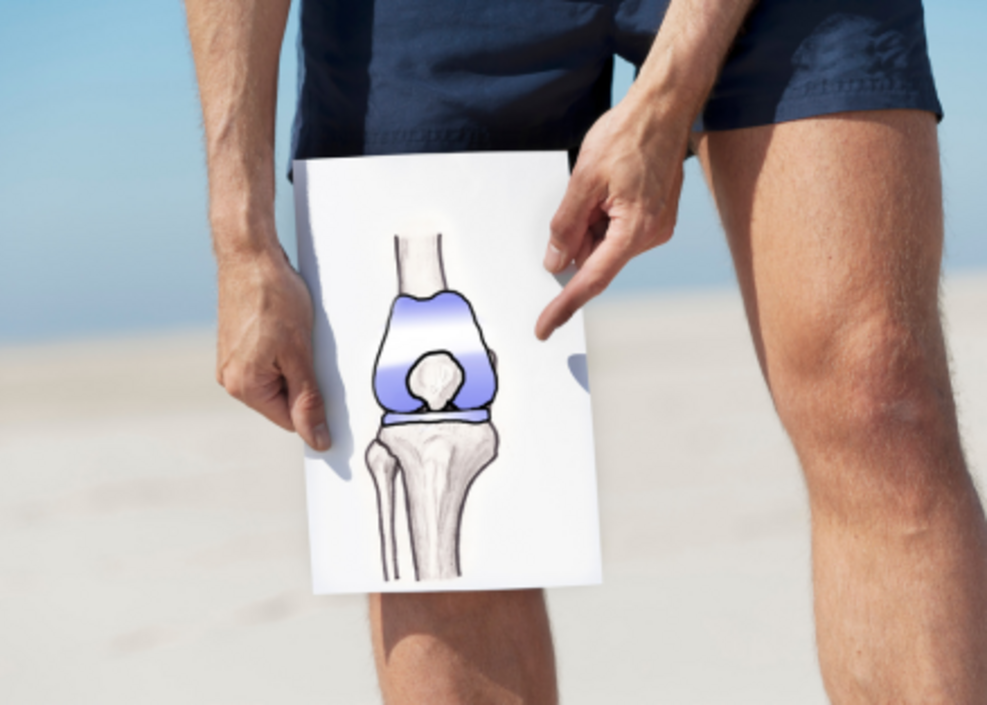 Total knee replacement